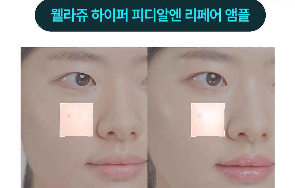 [NEW/수분광채] 웰라쥬 하이퍼 PDRN 리페어 앰플 30ml 상세페이지 11